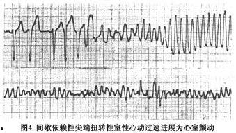 心动频率,揭秘心动频率的奥秘